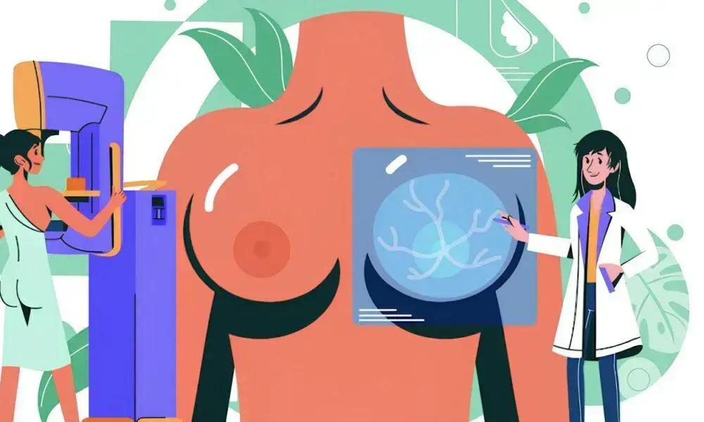 Campanha de Mamografia Gratuita em SP Pode Salvar Vidas e Promover Prevenção